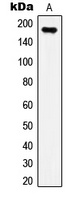 IRS1 (Phospho-S307) Antibody