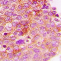 IRS1 (Phospho-S307) Antibody