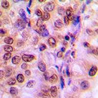 IRS1 Antibody
