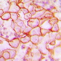 Anti-CD61 Antibody