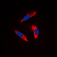 Anti-CD61 Antibody