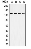 CD61 Rabbit Polyclonal Antibody