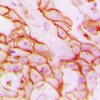 CD61 Rabbit Polyclonal Antibody