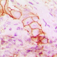 CD104 Rabbit Polyclonal Antibody
