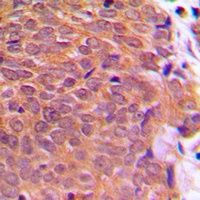 Anti-Cofilin (Phospho-S3) Antibody