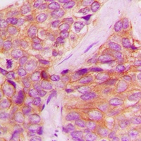 JAK1 (Phospho-Y1022) Antibody