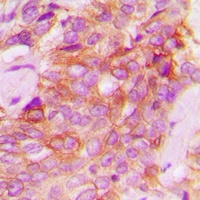 JAK1 Antibody