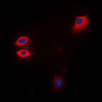 JAK1 antibody