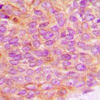 JAK2 (Phospho-Y1007) Antibody
