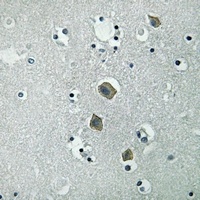 JAK2 (Phospho-Y570) Antibody