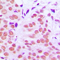c-Jun (Phospho-T91) Antibody