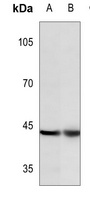 c-Jun (Phospho-Y170) Antibody