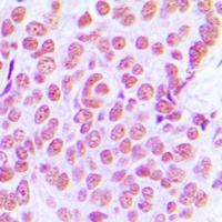 c-Jun Rabbit Polyclonal Antibody