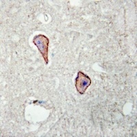 Anti-Kv1.3 (Phospho-Y187) Antibody