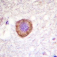 Anti-Kv1.3 Antibody