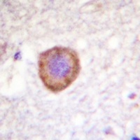 KCNA3 antibody