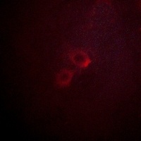 Anti-Kv1.3 Antibody