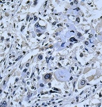 Anti-Kv1.5 Antibody