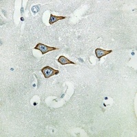 Anti-Kv3.1 Antibody