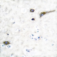 Anti-Kv3.2 Antibody