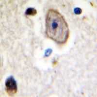 Anti-Kv3.4 Antibody