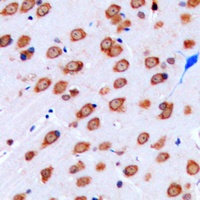 Anti-Kir3.3 Antibody