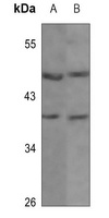 Kir4.1 Rabbit Polyclonal Antibody