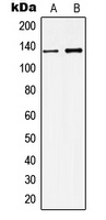 KCNMA1 Rabbit Polyclonal Antibody