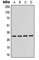 CD158b1 Rabbit Polyclonal Antibody