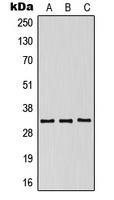 CD158g Rabbit Polyclonal Antibody