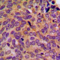 Anti-Cytokeratin 5 Antibody