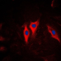Anti-Cytokeratin 5 Antibody