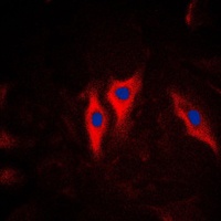 KRT5 antibody