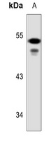 Cytokeratin 7 Antibody [KO/KD Validated]