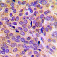 Anti-Cytokeratin 7 Antibody
