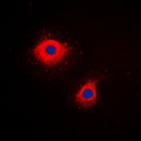 Anti-Cytokeratin 7 Antibody