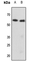 Cytokeratin 8 (Phospho-S73) Antibody