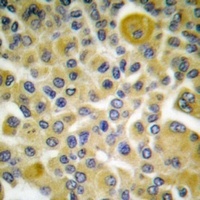 Cytokeratin 8 (Phospho-S73) Antibody