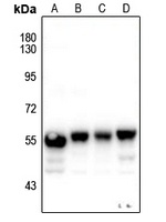 Cytokeratin 8 Rabbit Polyclonal Antibody