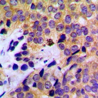 Anti-Cytokeratin 8 Antibody