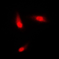 Anti-Cytokeratin 8 Antibody