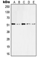 Cytokeratin 10 Rabbit Polyclonal Antibody