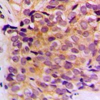 Anti-Cytokeratin 10 Antibody