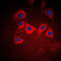 Anti-Cytokeratin 10 Antibody
