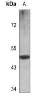 Cytokeratin 13 Rabbit Polyclonal Antibody
