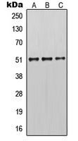 Cytokeratin 14 Antibody