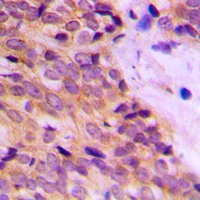 Anti-Cytokeratin 14 Antibody