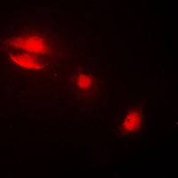 Anti-Cytokeratin 14 Antibody