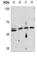 Cytokeratin 16 Antibody