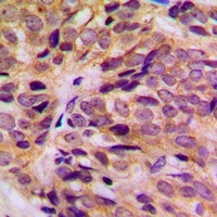 Anti-Cytokeratin 16 Antibody